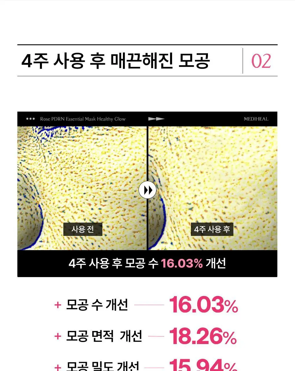 [15년연속 1위/4매] 메디힐 에센셜 마스크팩 고기능 7종 골라담기 상세페이지 33